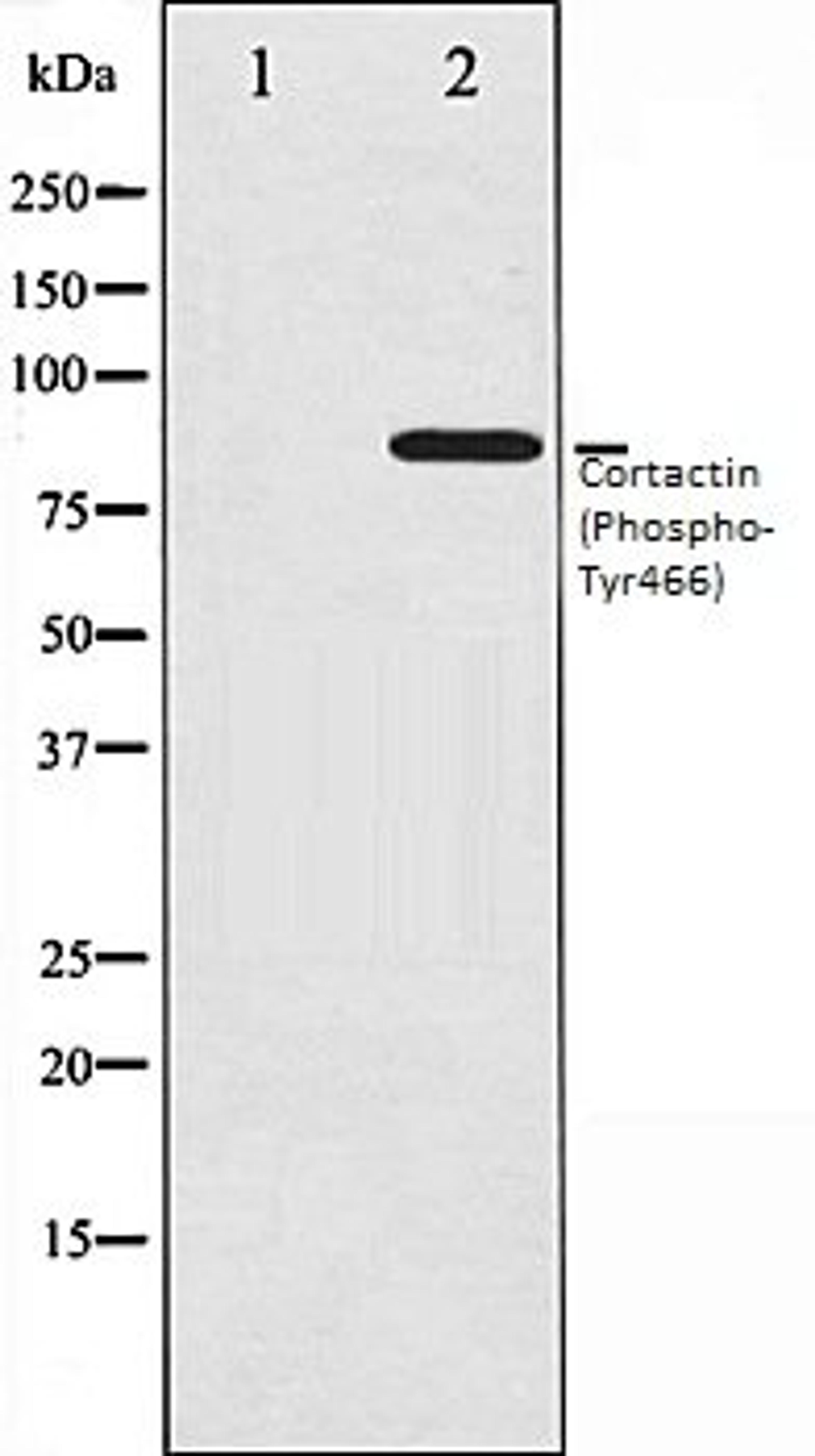 Western blot analysis of COS7 whole cell lysates using Cortactin (Phospho-Tyr466) antibody, The lane on the left is treated with the antigen-specific peptide.