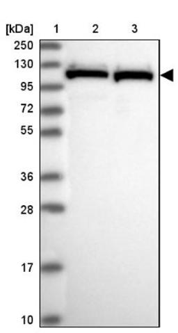 Western Blot: PRPF6 Antibody [NBP1-92298] - Lane 1: Marker [kDa] 250, 130, 95, 72, 55, 36, 28, 17, 10<br/>Lane 2: Human cell line RT-4<br/>Lane 3: Human cell line U-251MG sp