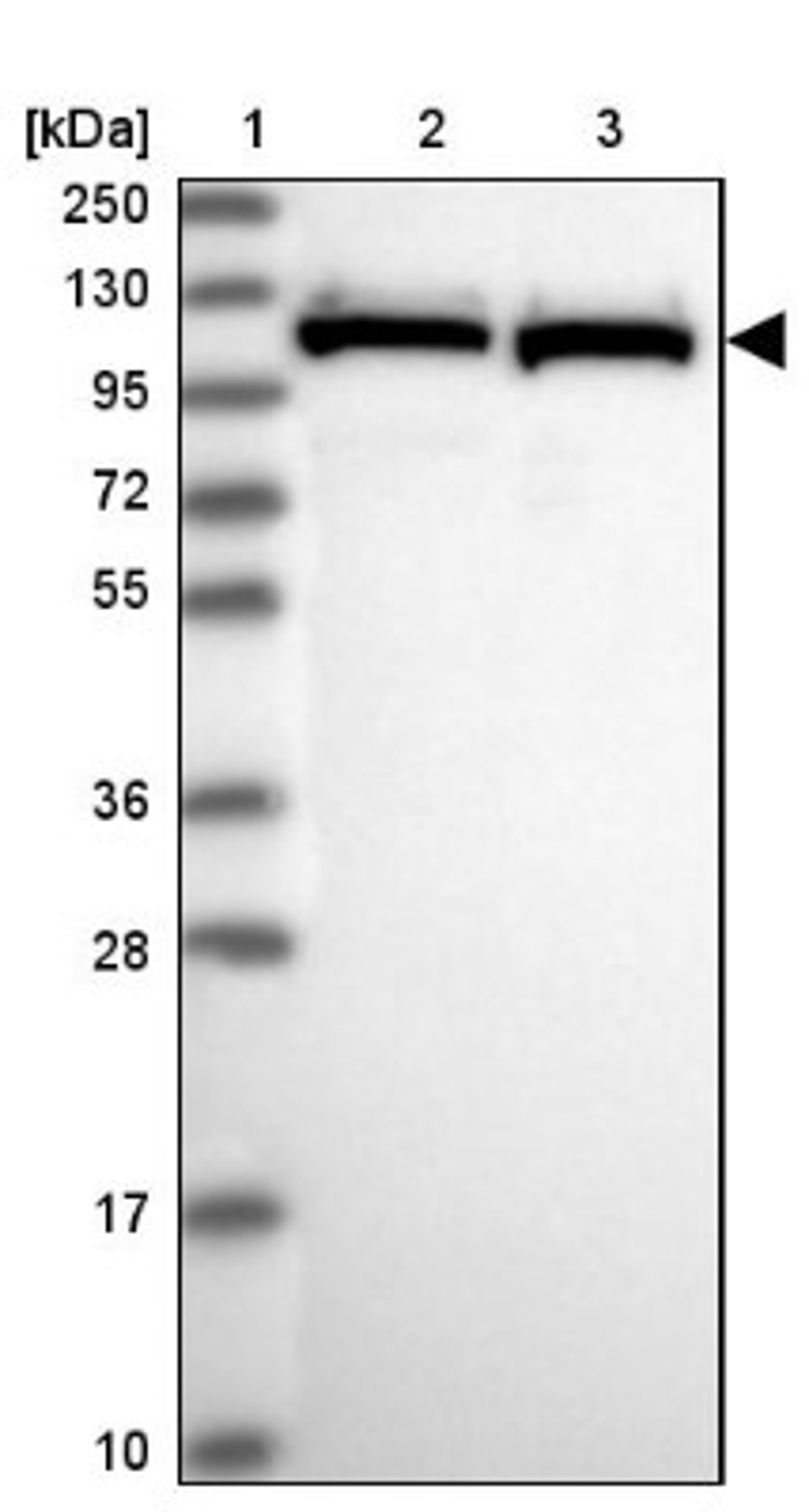 Western Blot: PRPF6 Antibody [NBP1-92298] - Lane 1: Marker [kDa] 250, 130, 95, 72, 55, 36, 28, 17, 10<br/>Lane 2: Human cell line RT-4<br/>Lane 3: Human cell line U-251MG sp