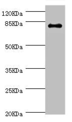 Western blot. All lanes: GBE1 antibody at 3.13ug/ml + Mouse liver tissue. Secondary. Goat polyclonal to rabbit IgG at 1/10000 dilution. predicted band size 80 kDa. Observed band size: 80 kDa.