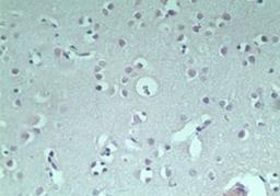 Immunohistochemistry-Paraffin: RNF128 Antibody [NBP2-24610] - IHC staining of normal human brain using control (rabbit Ig) at 5 ug/ml.