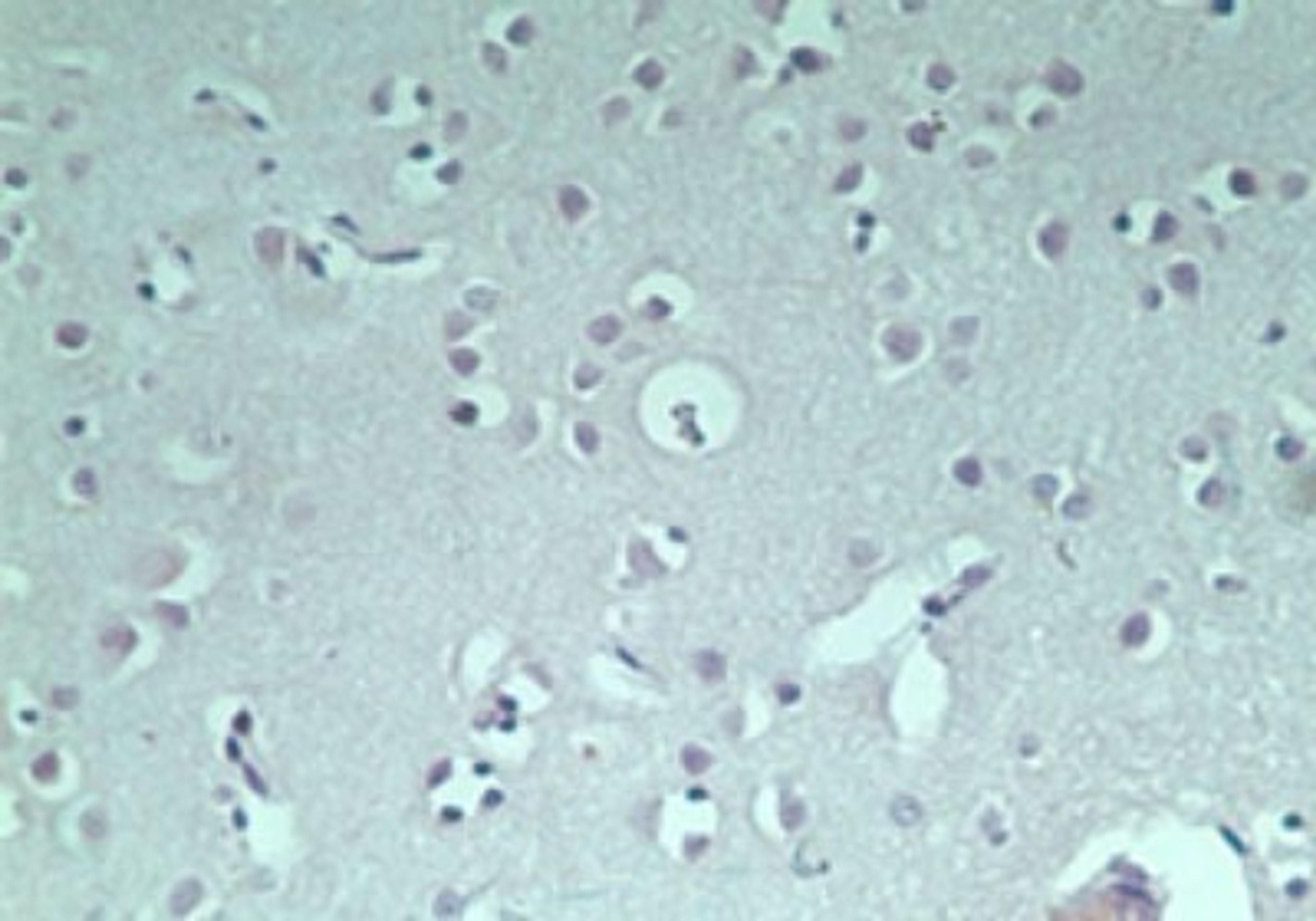 Immunohistochemistry-Paraffin: RNF128 Antibody [NBP2-24610] - IHC staining of normal human brain using control (rabbit Ig) at 5 ug/ml.