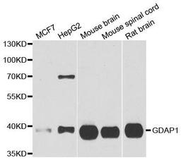 Western blot analysis of extracts of various cell lines using GDAP1 antibody