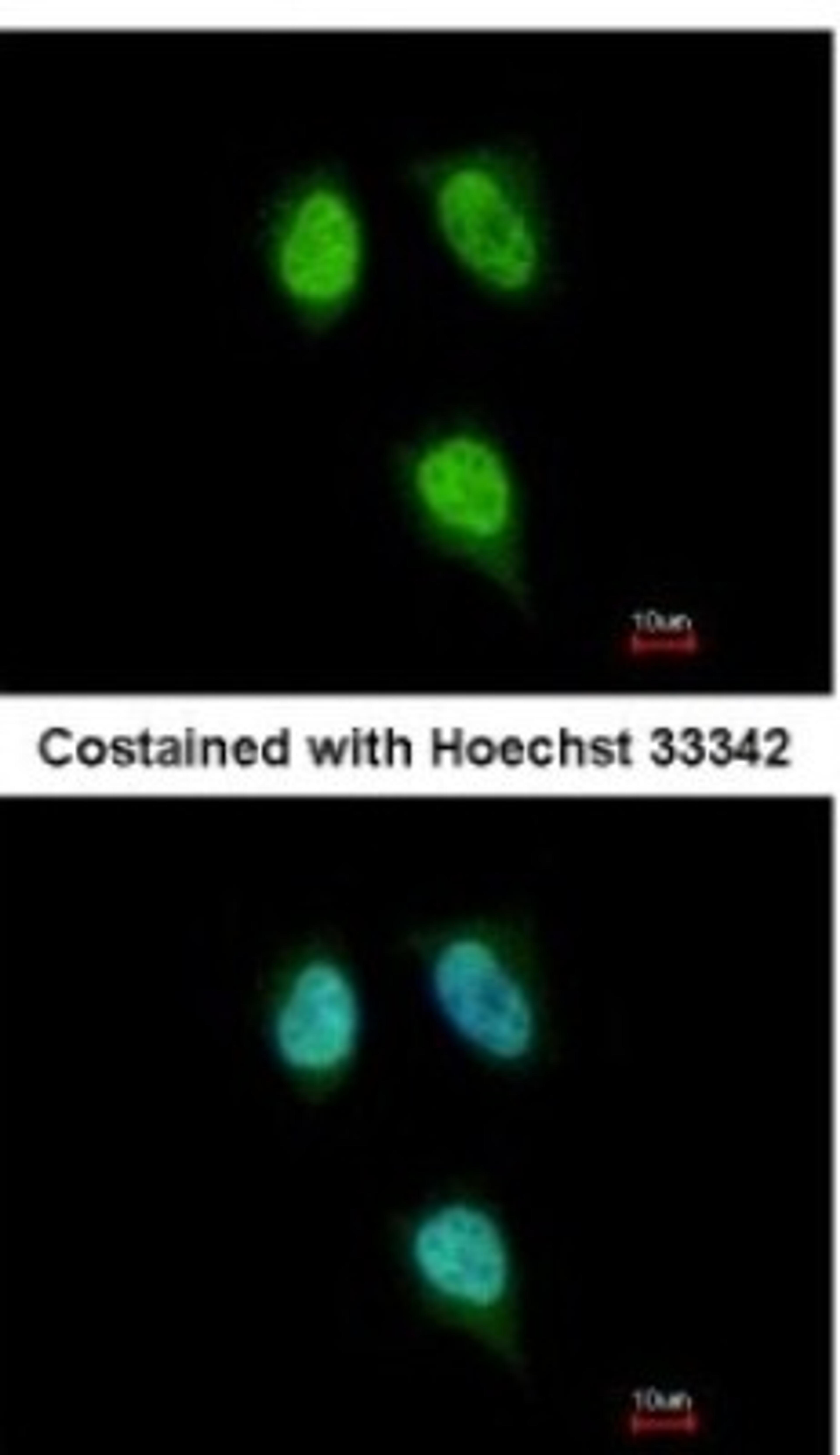 Immunocytochemistry/Immunofluorescence: PPIH Antibody [NBP2-19899] - Analysis of paraformaldehyde-fixed HeLa, using antibody at 1:200 dilution.