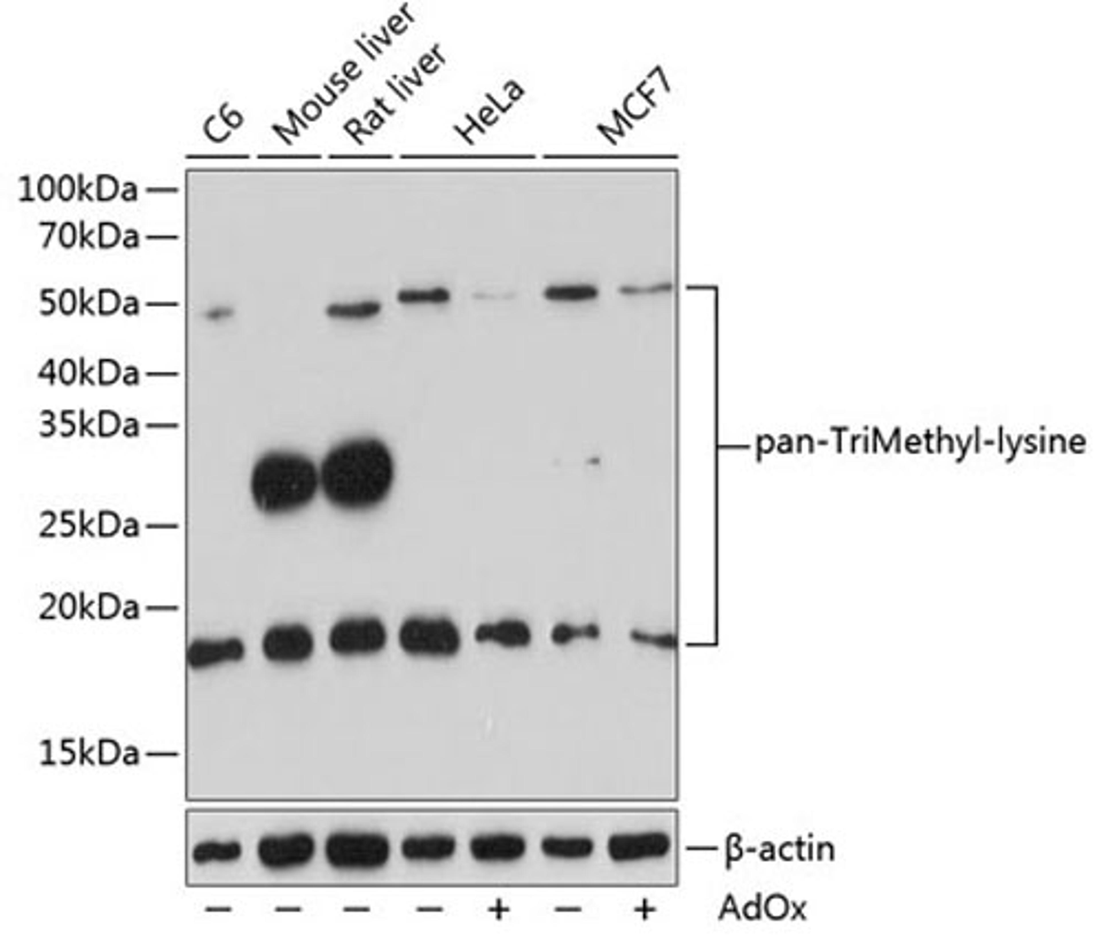 Western blot - pan-TriMethyl-lysine pAb (A18292)