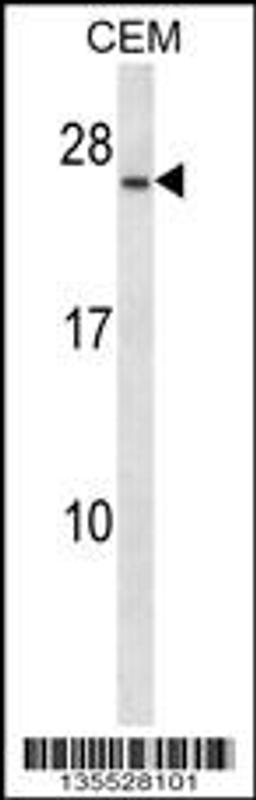 Western blot analysis in CEM cell line lysates (35ug/lane).