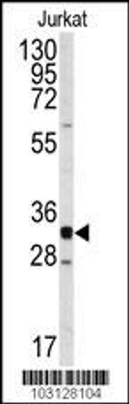 Western blot analysis of anti-CDK2 Antibody in Jurkat cell line lysates (35ug/lane)