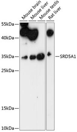 Western blot - SRD5A1 antibody (A14787)