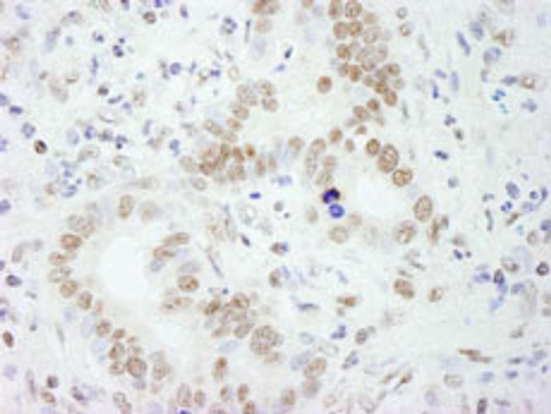 Detection of human PSF/SFPQ by immunohistochemistry.