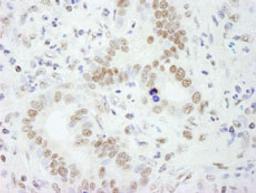 Detection of human PSF/SFPQ by immunohistochemistry.