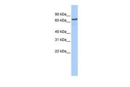 Antibody used in WB on Human Placenta at 0.2-1 ug/ml.