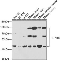 Western blot - RTN4R antibody (A5847)