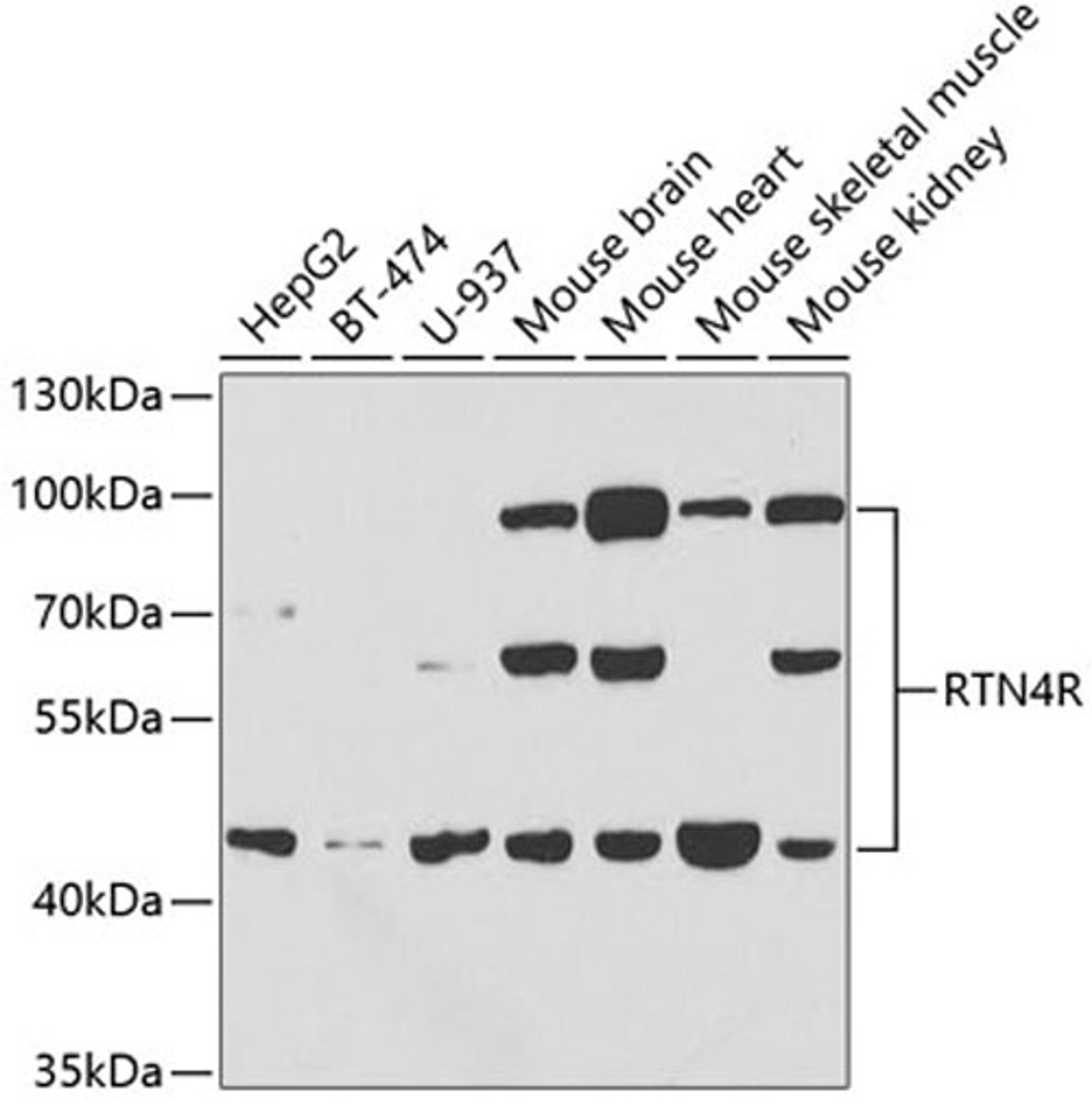 Western blot - RTN4R antibody (A5847)