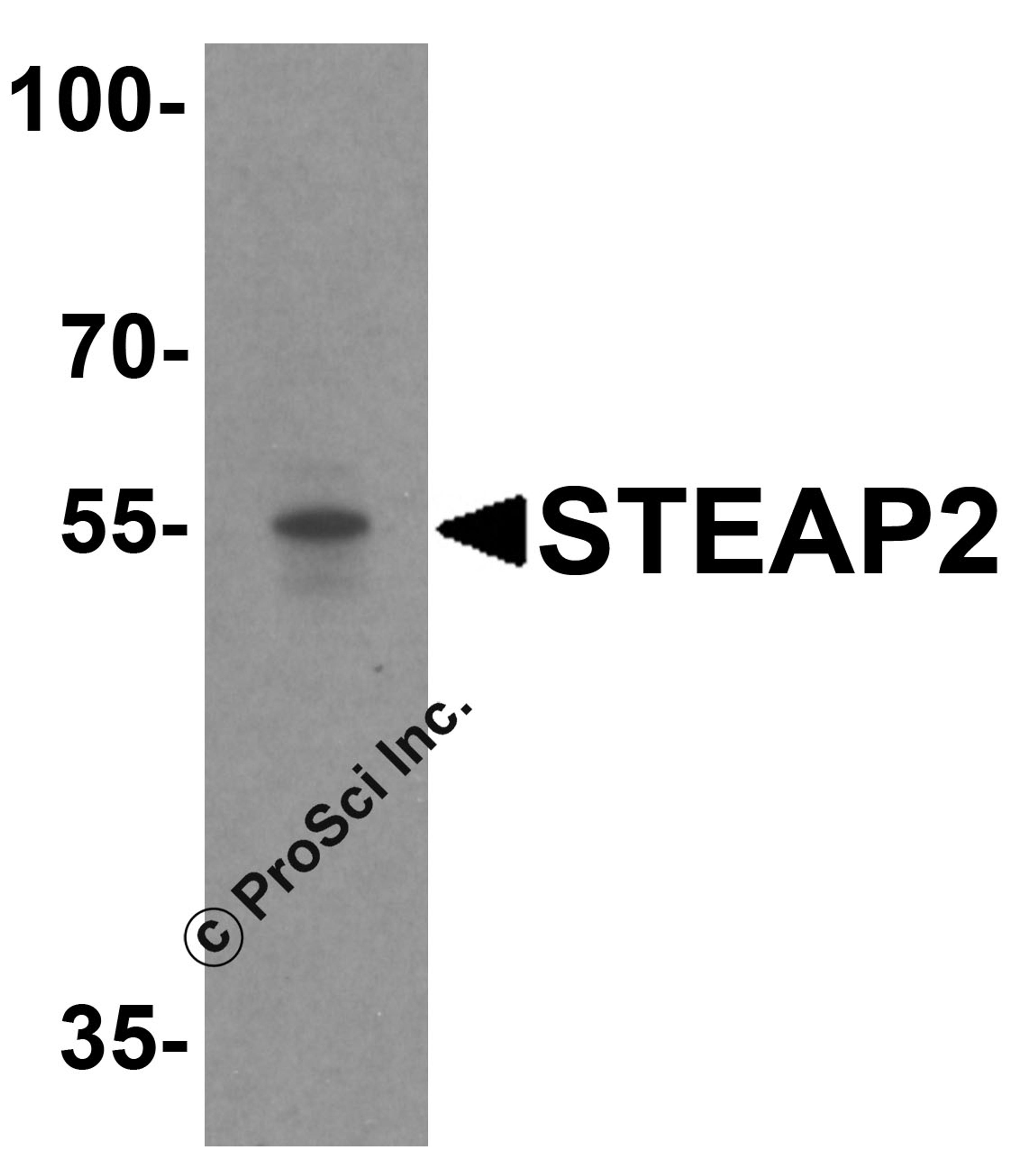 Western blot analysis of STEAP2 in human prostate tissue lysate with STEAP2 antibody at 1 μg/mL.