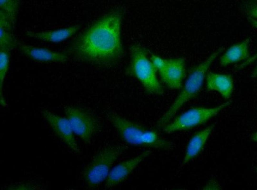 Immunocytochemistry/Immunofluorescence: Perilipin-2/ADFP Antibody [NB110-40877] - Detection of ADFP (Green) in Hela cells using NB110-40877 at a 1:50 dilution.  Nuclei (Blue) were counterstained using Hoechst 33258.