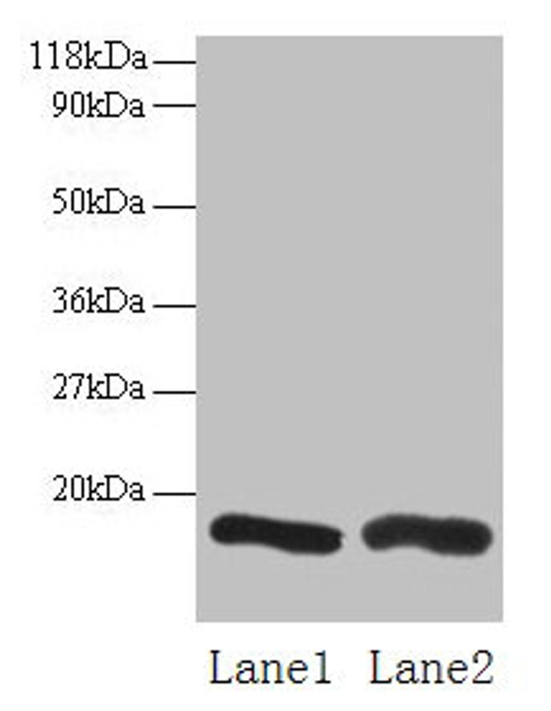 Western blot. All lanes: CHMP2A antibody at 2µg/ml. Lane 1: EC109 whole cell lysate. Lane 2: 293T whole cell lysate. Secondary. Goat polyclonal to rabbit IgG at 1/15000 dilution. Predicted band size: 26 kDa. Observed band size: 16 kDa