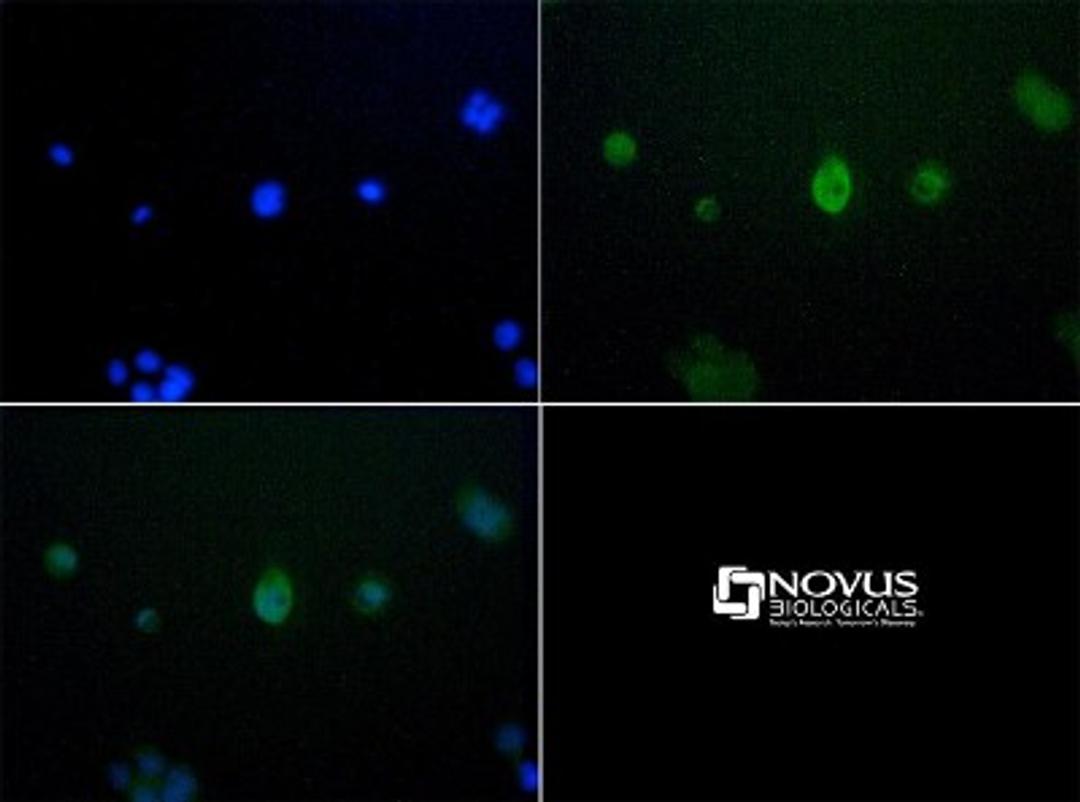 Immunocytochemistry/Immunofluorescence: JMJD6 Antibody [NBP1-71693] - JMJD6 antibody was tested at 10 ug/ml in A431 cells with FITC (green). Nuclei (Blue) were counterstained with Dapi (blue).