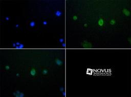 Immunocytochemistry/Immunofluorescence: JMJD6 Antibody [NBP1-71693] - JMJD6 antibody was tested at 10 ug/ml in A431 cells with FITC (green). Nuclei (Blue) were counterstained with Dapi (blue).