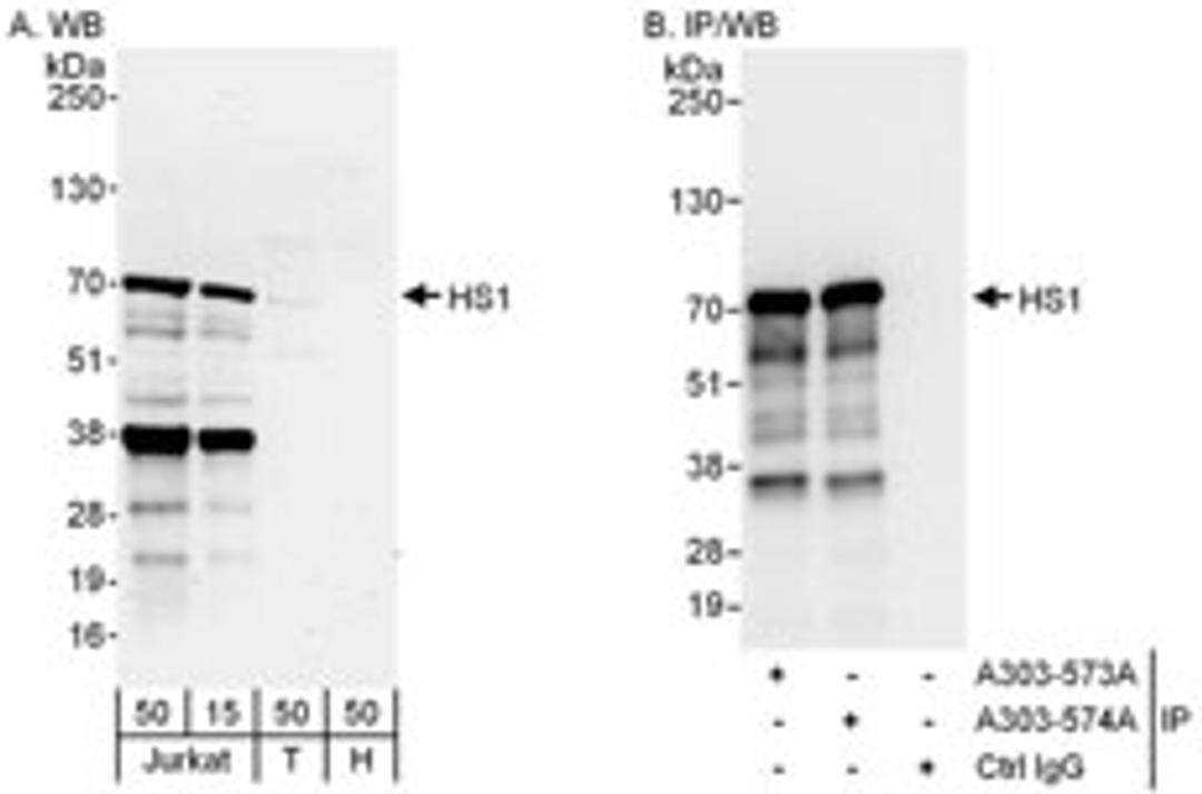 Detection of human HS1 by western blot and immunoprecipitation.