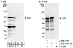 Detection of human HS1 by western blot and immunoprecipitation.