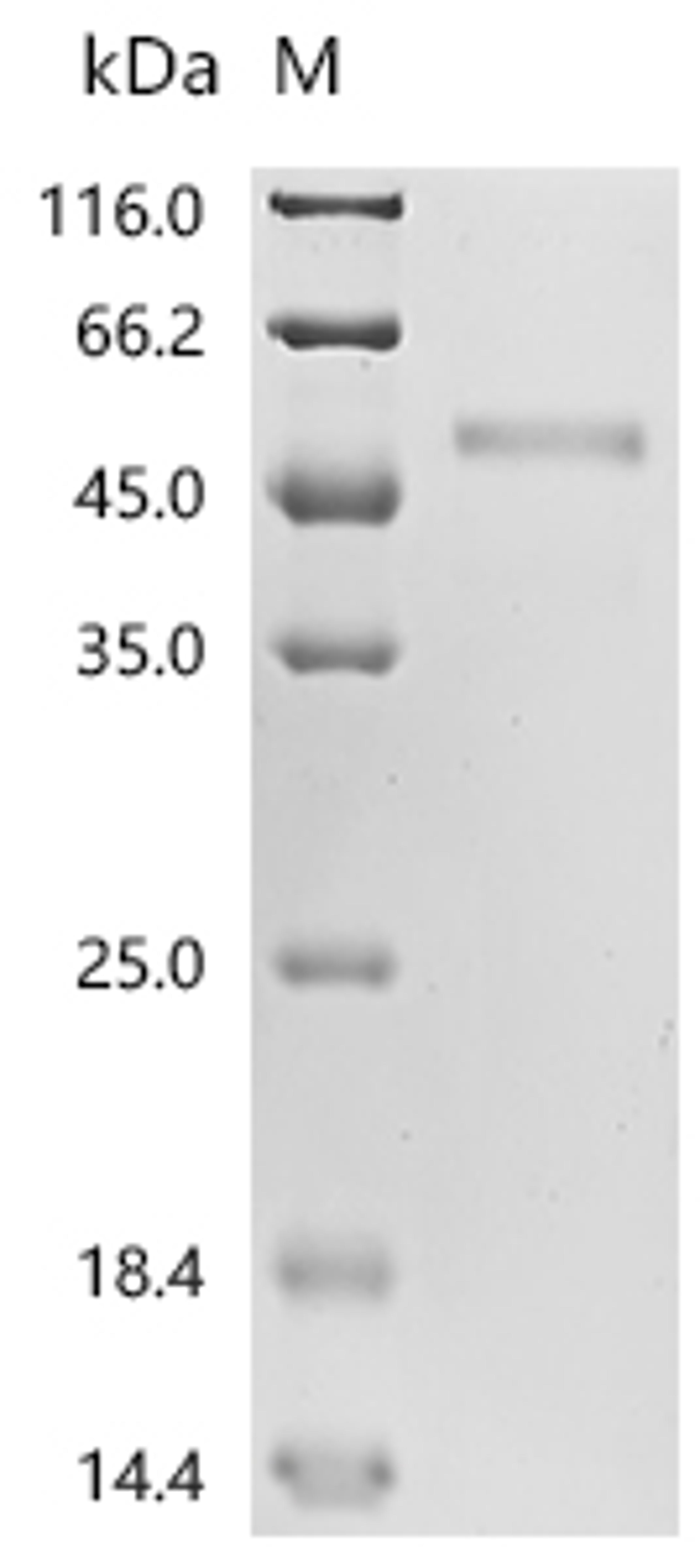 (Tris-Glycine gel) Discontinuous SDS-PAGE (reduced) with 5% enrichment gel and 15% separation gel.