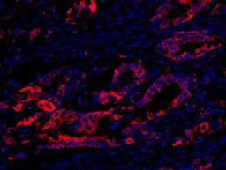 Detection of human eEF2 Kinase by IHC-IF.