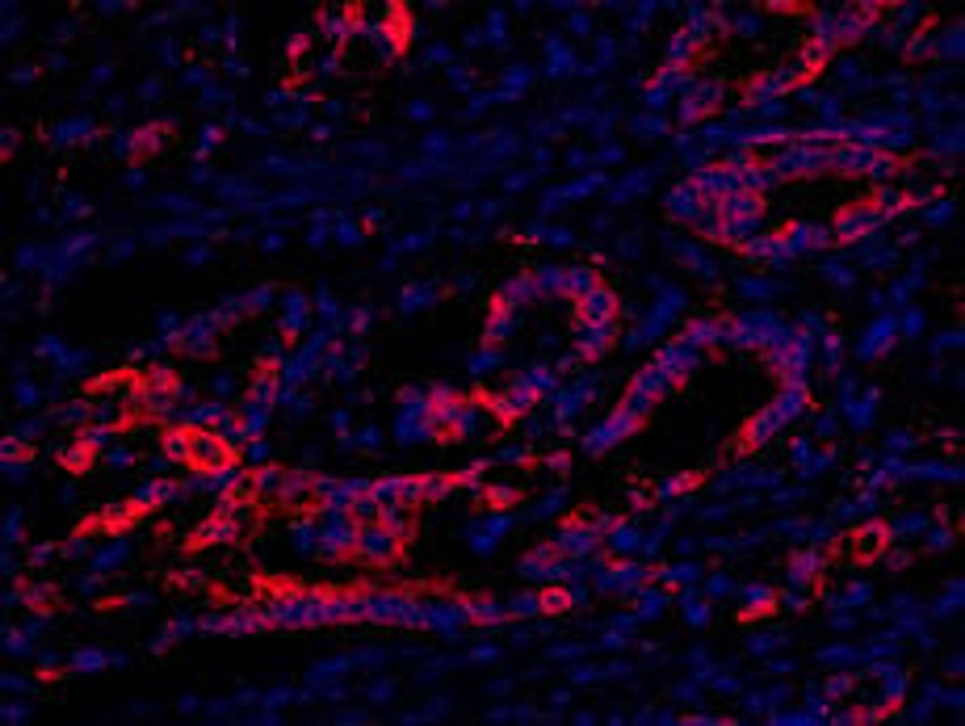 Detection of human eEF2 Kinase by IHC-IF.