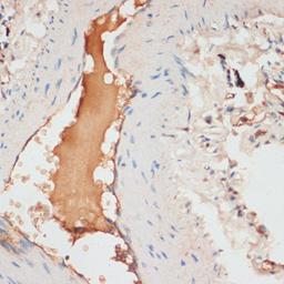 Immunohistochemistry - APOC1 antibody (A5629)