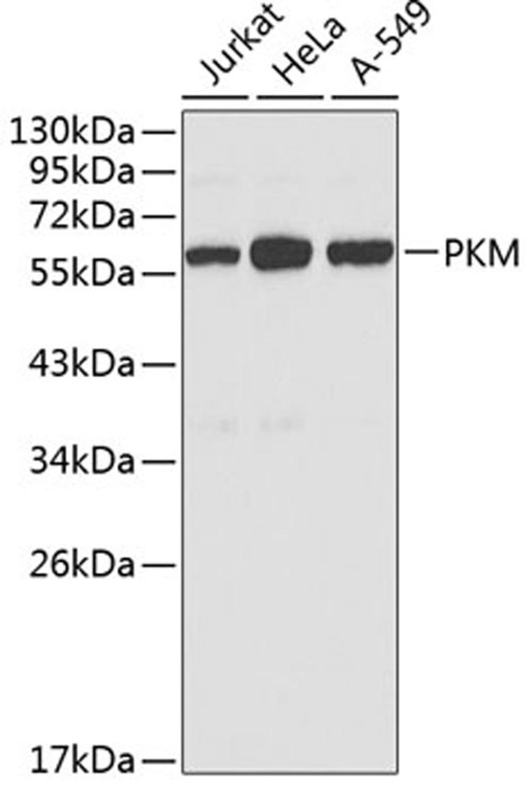 Western blot - PKM antibody (A0268)