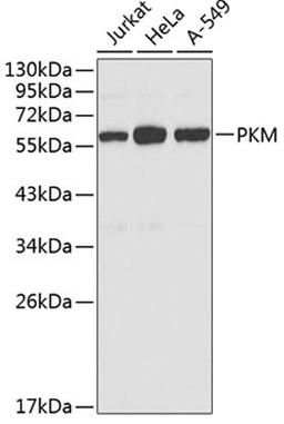 Western blot - PKM antibody (A0268)