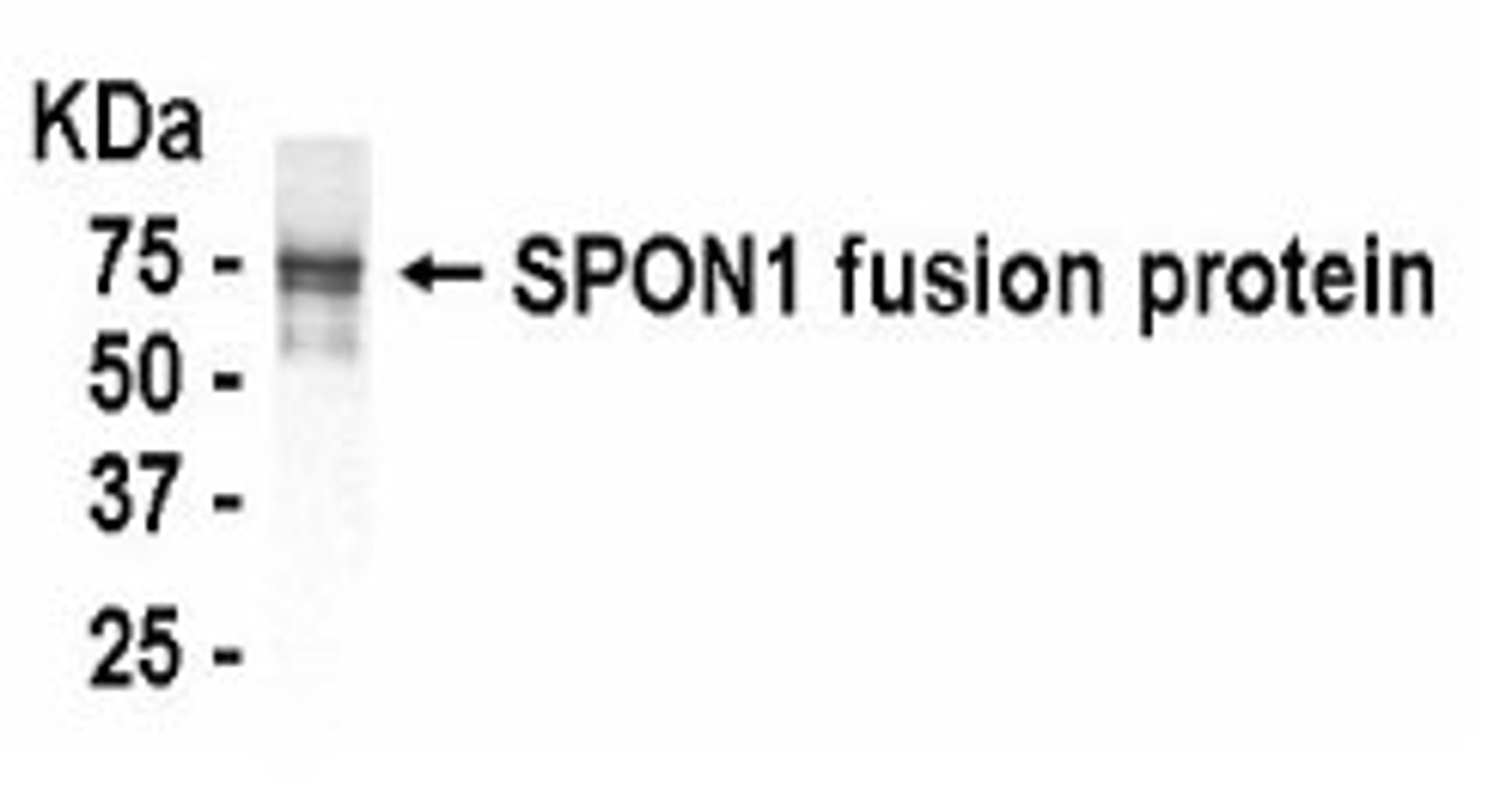 Western Blot analysis of SPON1 using XW-7587 at a 1:2,000 dilution. E coli-derived fusion protein as test antigen.