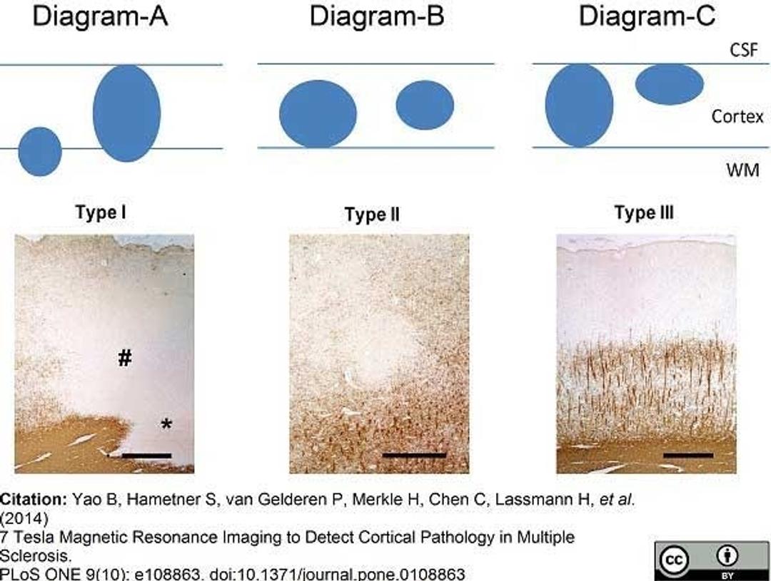 Mouse anti myelin proteolipid protein used for the detection of proteolipid protein