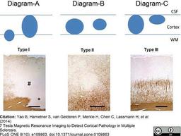 Mouse anti myelin proteolipid protein used for the detection of proteolipid protein