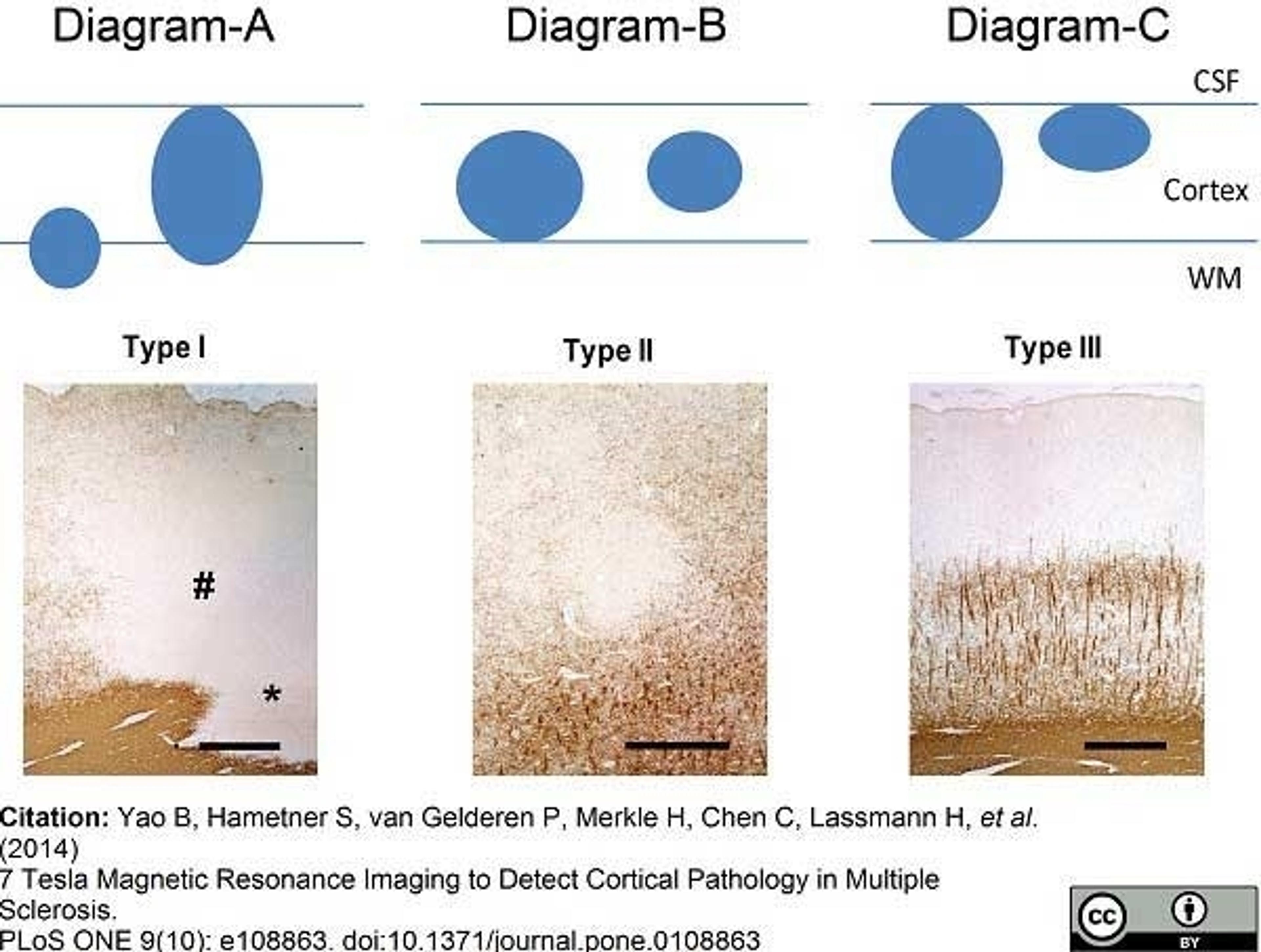 Mouse anti myelin proteolipid protein used for the detection of proteolipid protein