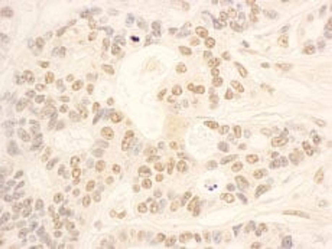 Detection of human NOP58 by immunohistochemistry.