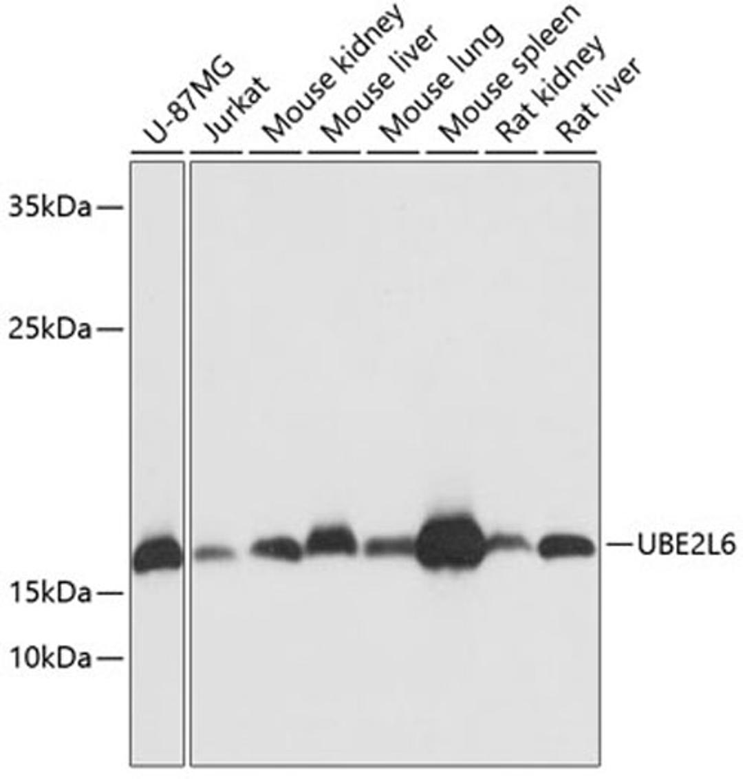 Western blot - UBE2L6 antibody (A13670)