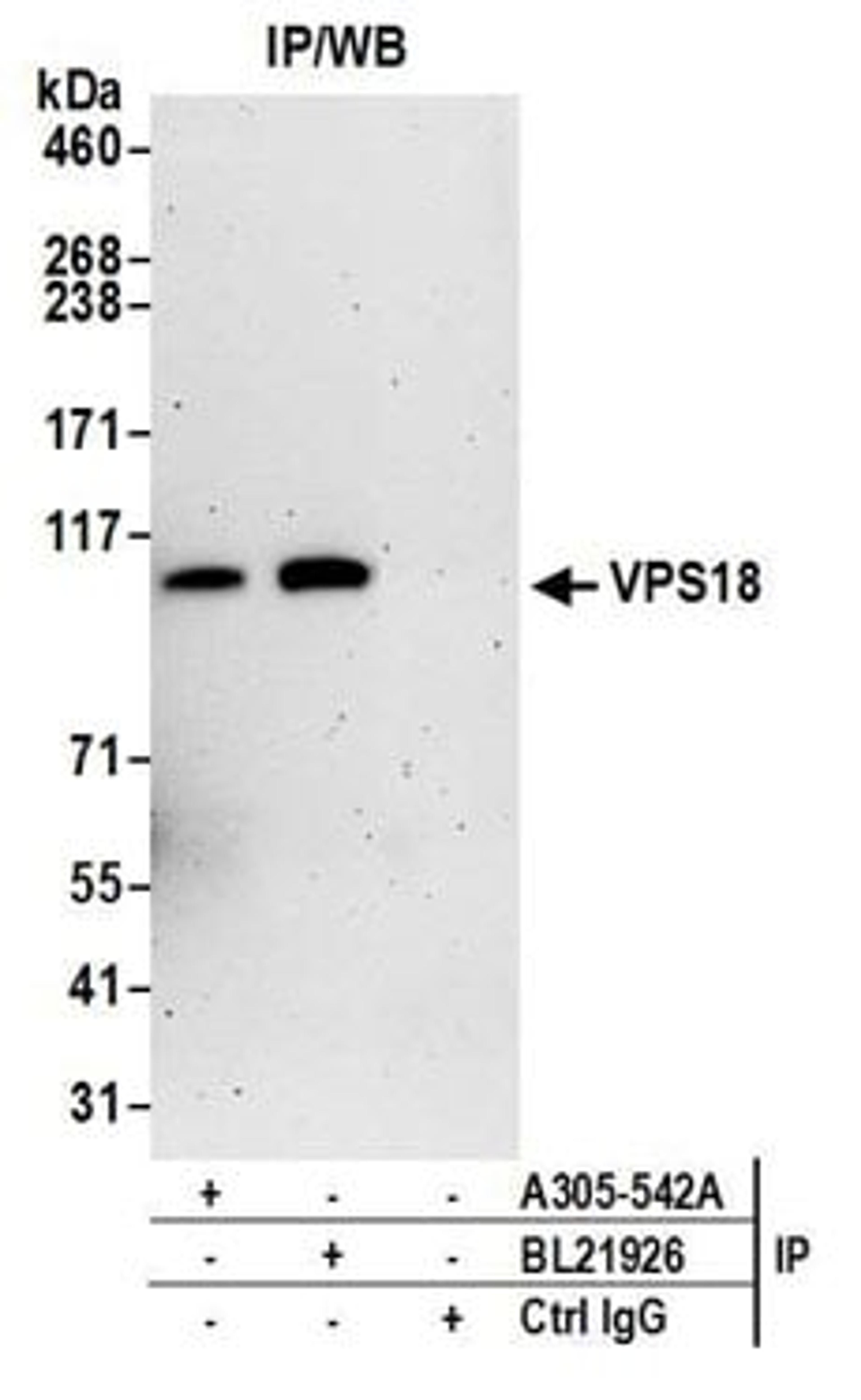 Detection of human VPS18 by western blot of immunoprecipitates.