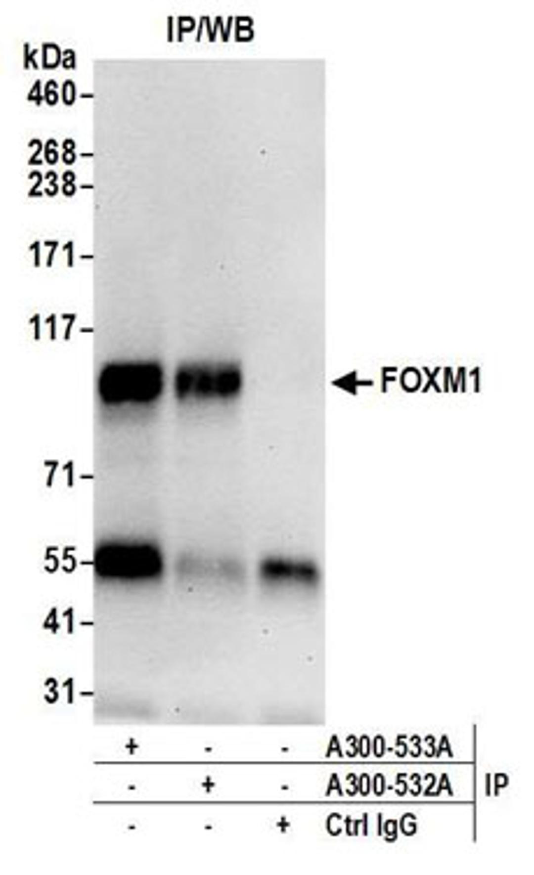 Detection of human FOXM1 by western blot of immunoprecipitates.