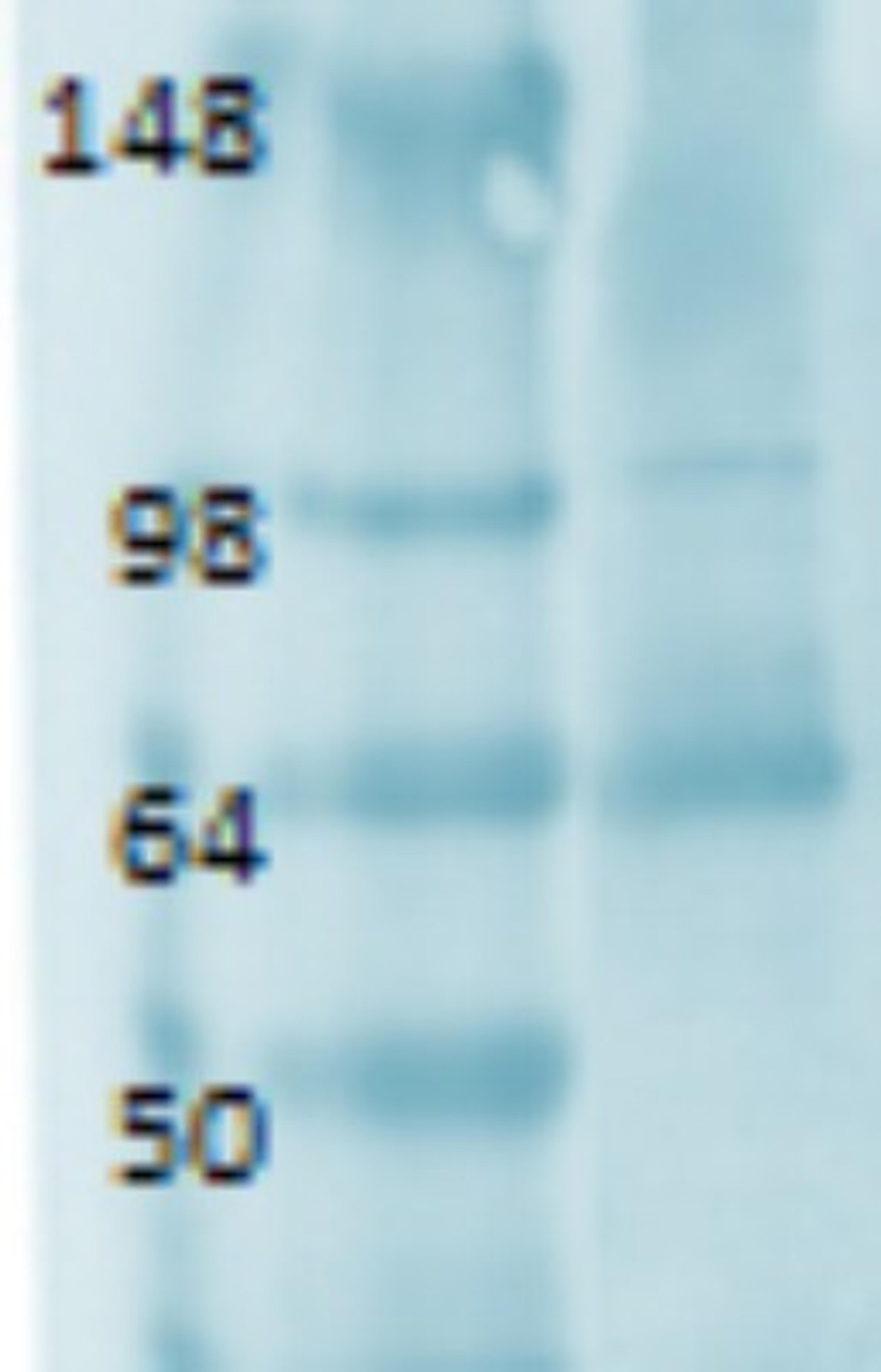 Western Blot: Sodium Iodide Symporter Antibody (FP5) [NBP1-70342] - Human retina lysate, using a 1:1000 dilution.