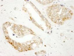 Detection of human DOCK4 by immunohistochemistry.