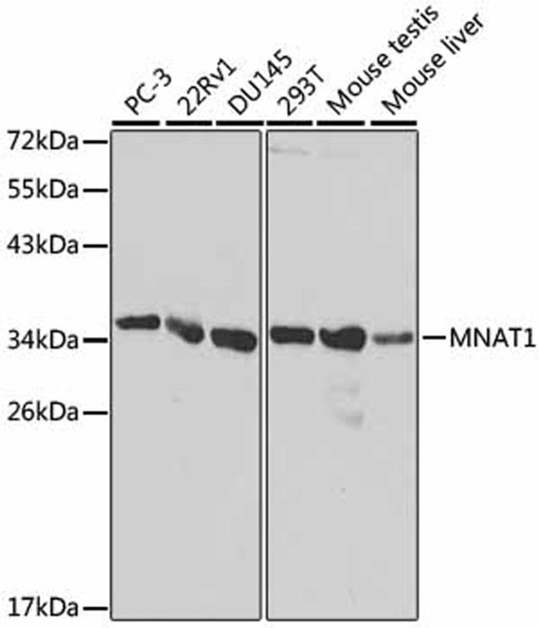 Western blot - MNAT1 antibody (A1918)