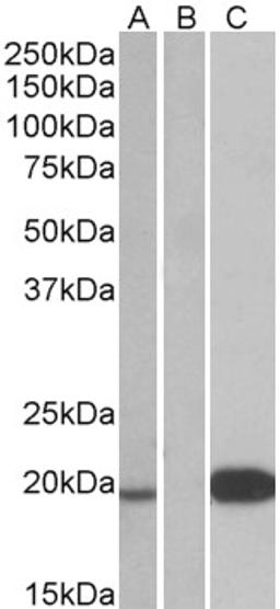 HEK293 lysate (10ug protein in RIPA buffer) over expressing Human UCN3 with DYKDDDDK tag probed with 46-722 (1ug/ml) in Lane A and probed with anti- DYKDDDDK Tag (1/3000) in lane C. Mock-transfected HEK293 probed with 46-722 (1mg/ml) in Lane B. Primary 