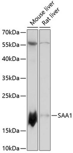 Western blot - SAA1 antibody (A14553)