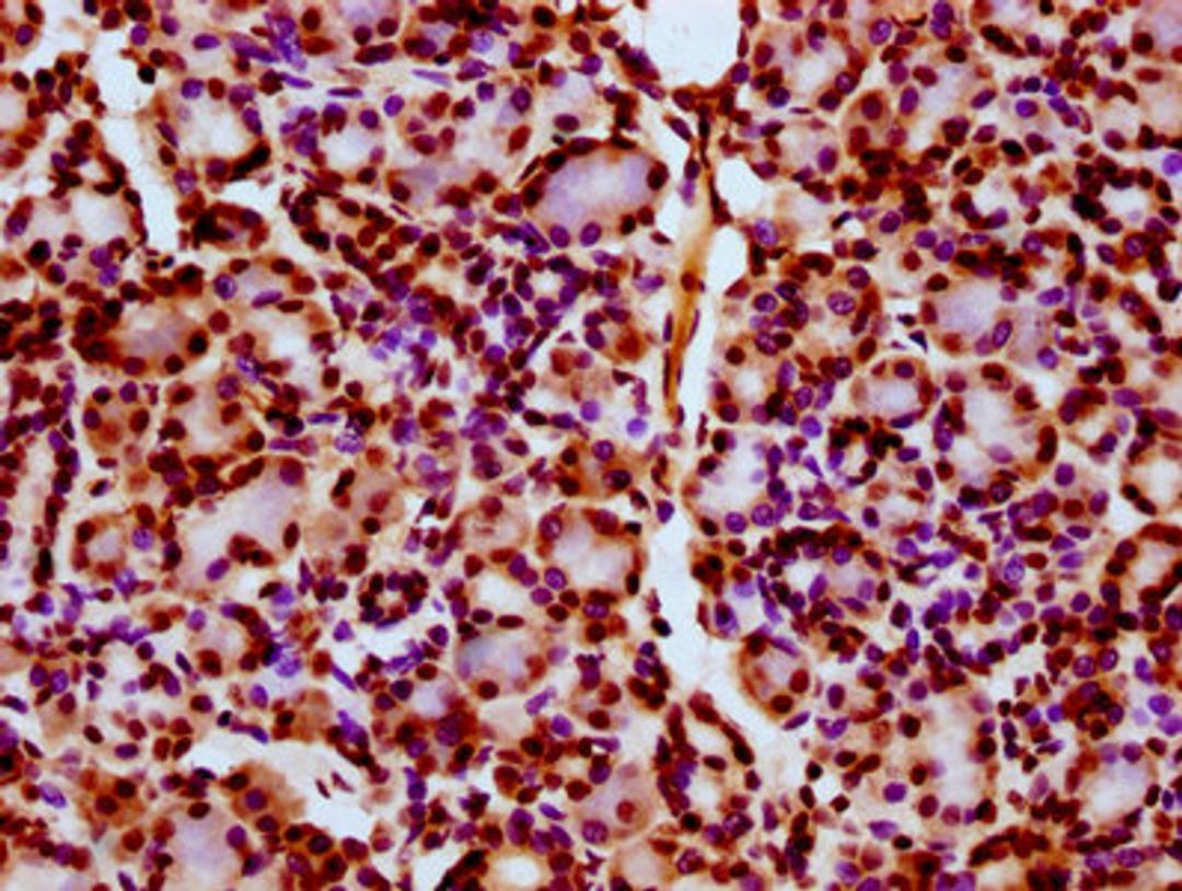 IHC image of CSB-PA010403OA11ncrHU diluted at 1:10 and staining in paraffin-embedded human pancreatic tissue performed on a Leica BondTM system. After dewaxing and hydration, antigen retrieval was mediated by high pressure in a citrate buffer (pH 6.0). Section was blocked with 10% normal goat serum 30min at RT. Then primary antibody (1% BSA) was incubated at 4&deg;C overnight. The primary is detected by a biotinylated secondary antibody and visualized using an HRP conjugated SP system.