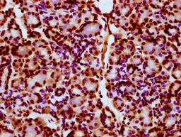 IHC image of CSB-PA010403OA11ncrHU diluted at 1:10 and staining in paraffin-embedded human pancreatic tissue performed on a Leica BondTM system. After dewaxing and hydration, antigen retrieval was mediated by high pressure in a citrate buffer (pH 6.0). Section was blocked with 10% normal goat serum 30min at RT. Then primary antibody (1% BSA) was incubated at 4&deg;C overnight. The primary is detected by a biotinylated secondary antibody and visualized using an HRP conjugated SP system.
