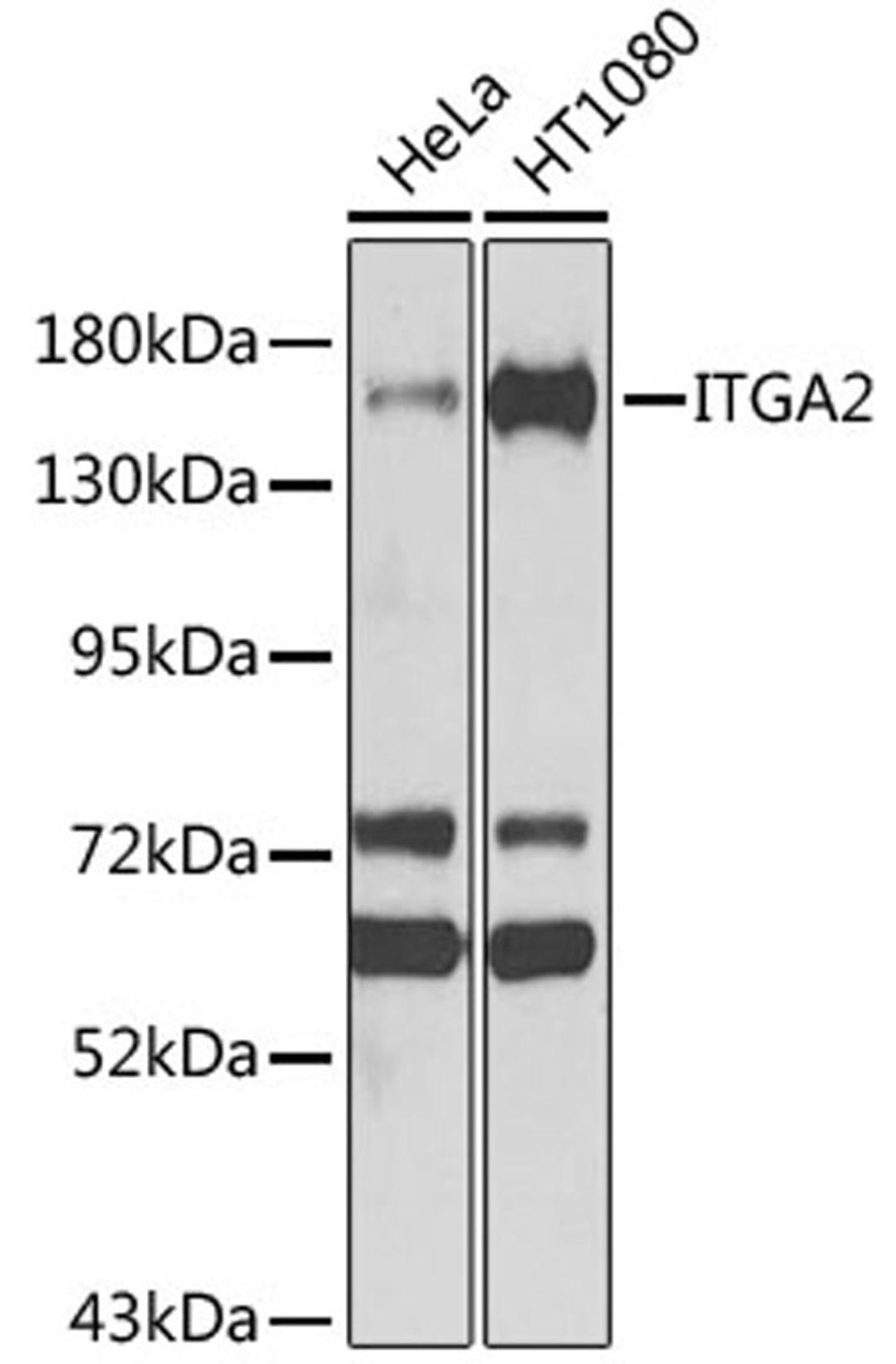 Western blot - ITGA2 antibody (A7629)