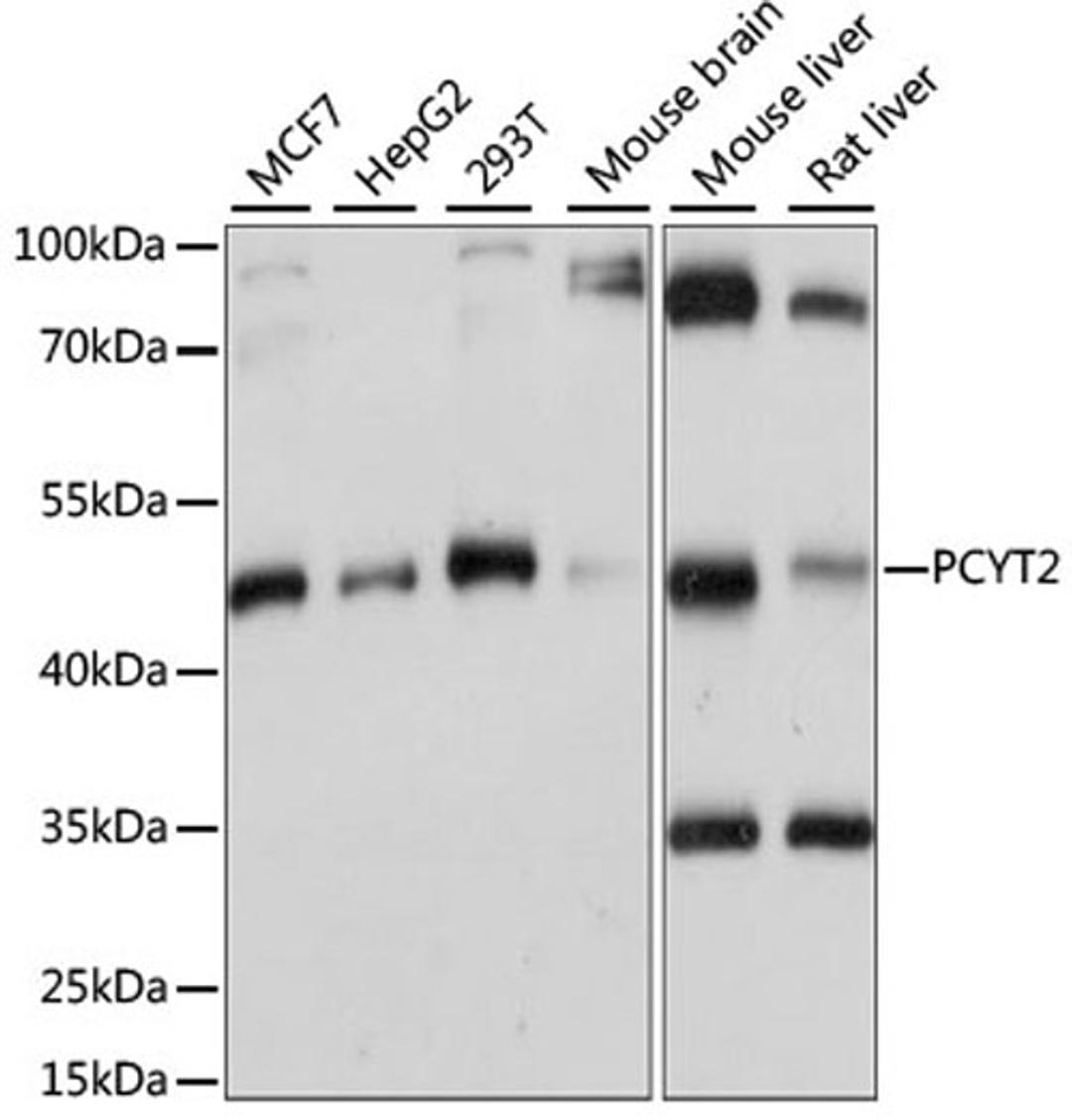 Western blot - PCYT2 antibody (A15309)