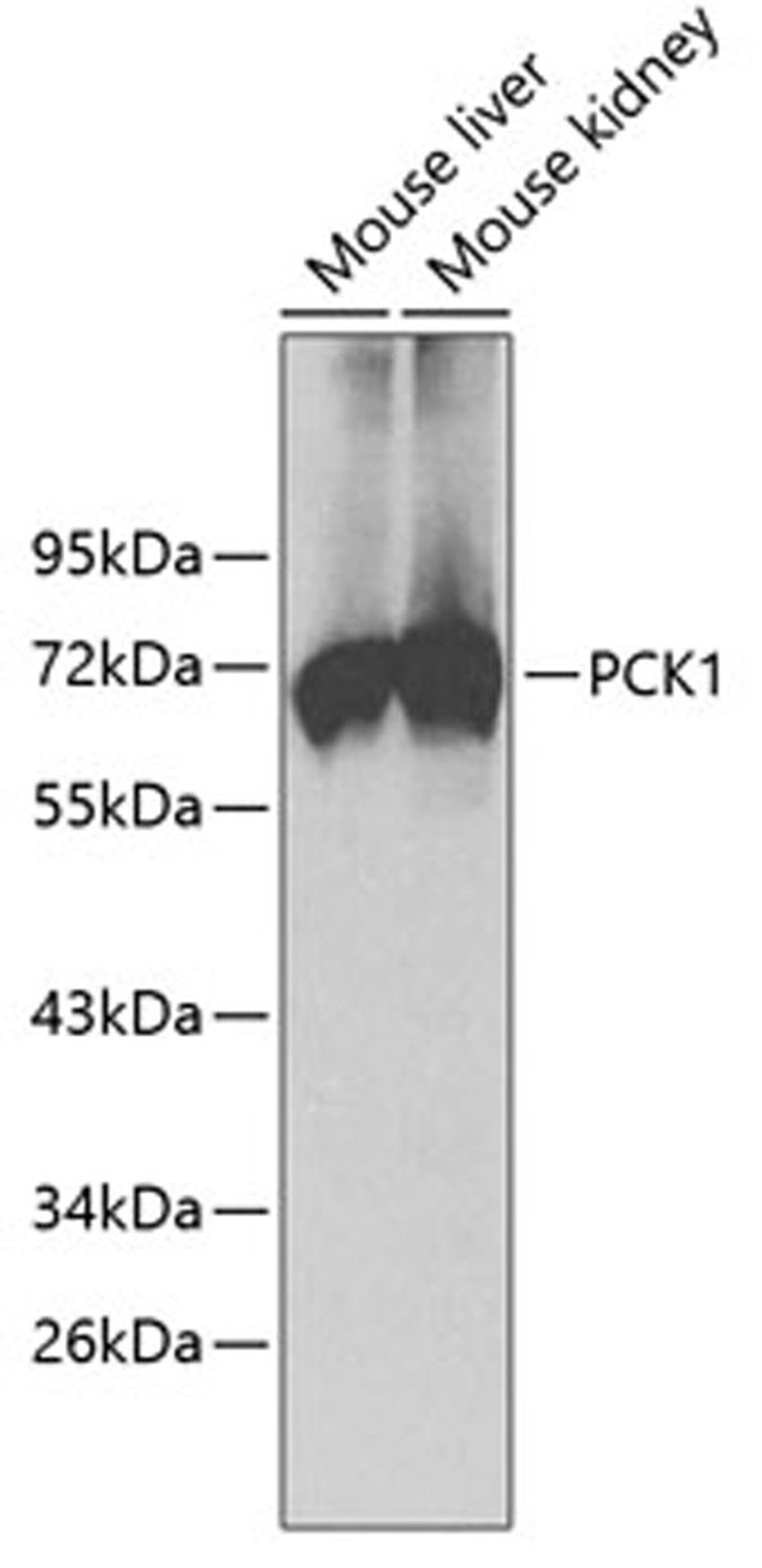 Western blot - PCK1 antibody (A2036)