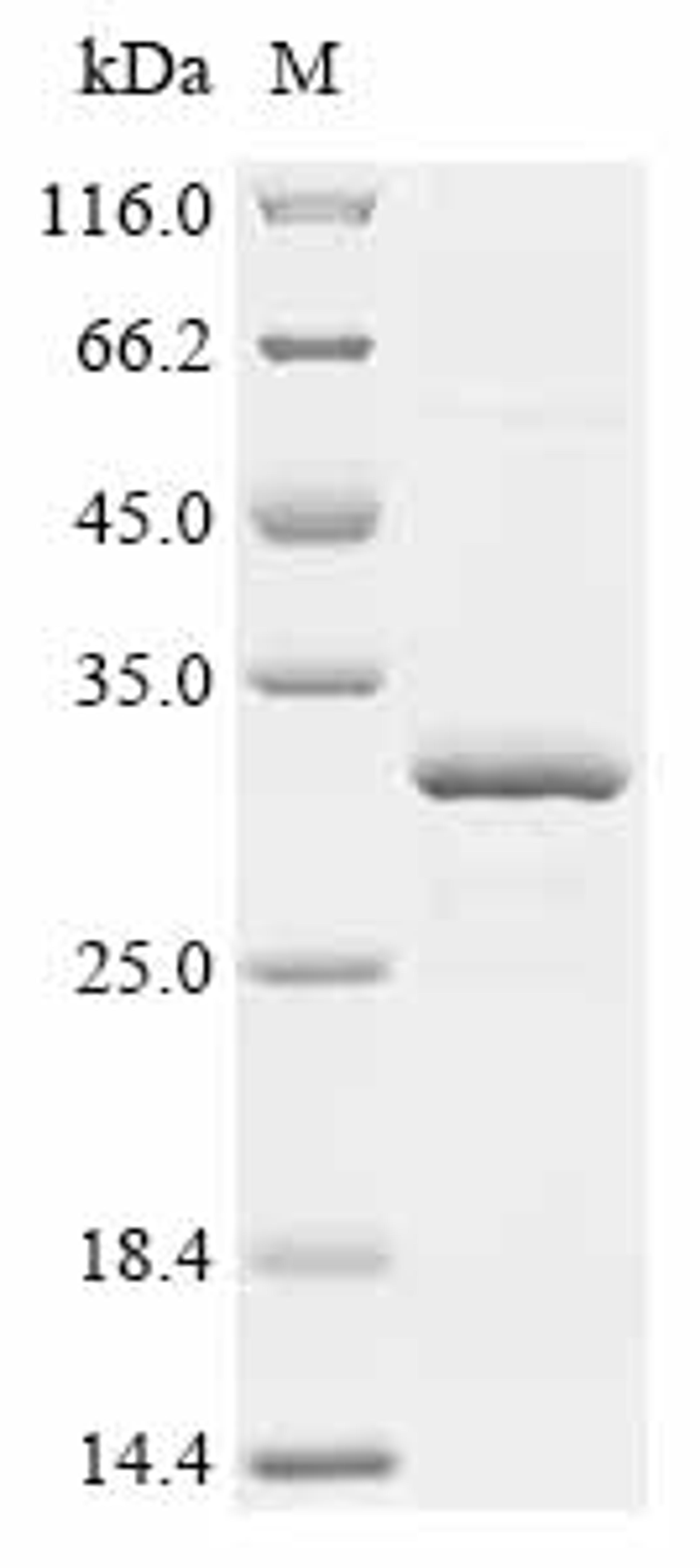 (Tris-Glycine gel) Discontinuous SDS-PAGE (reduced) with 5% enrichment gel and 15% separation gel.