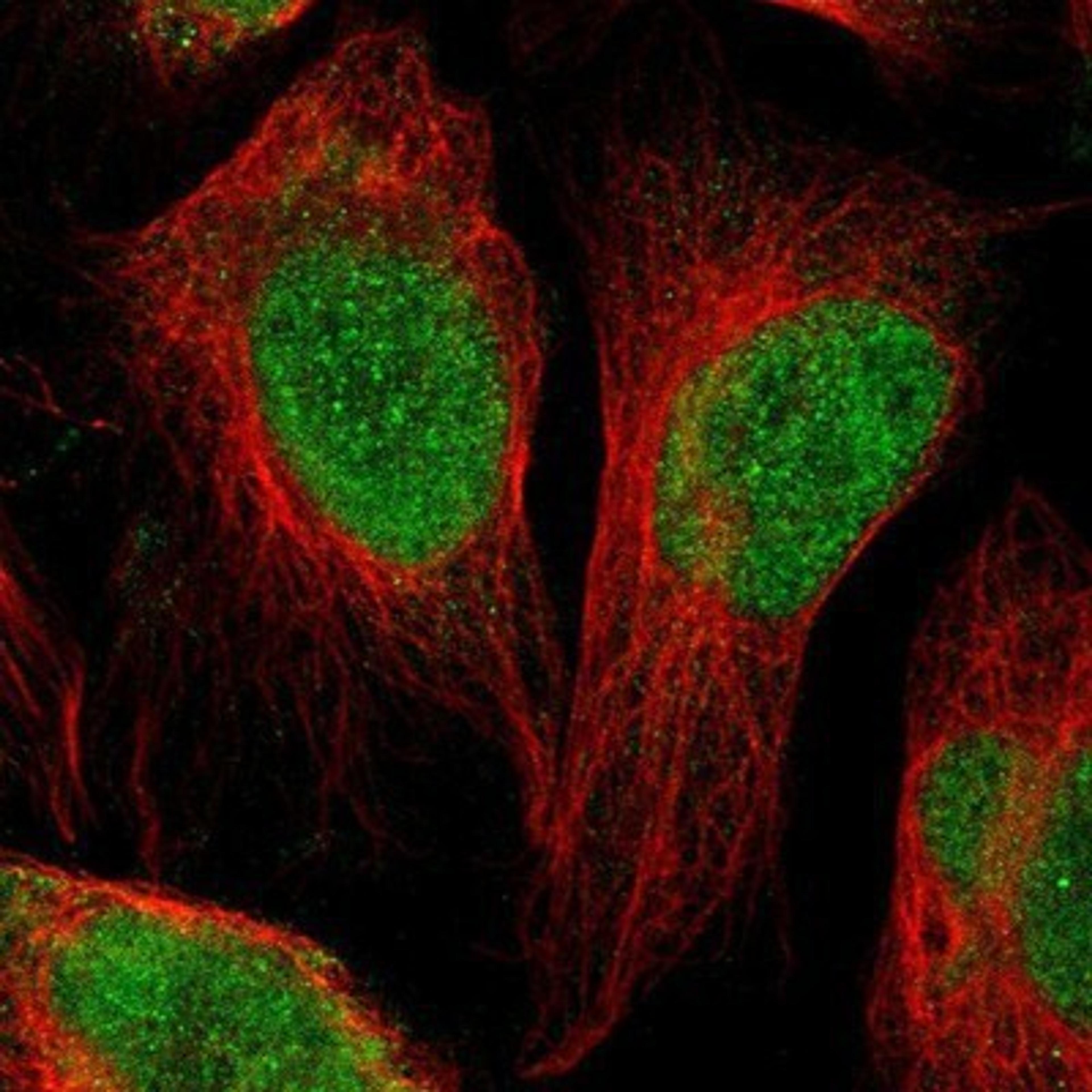 Immunocytochemistry/Immunofluorescence: MRG-binding protein Antibody [NBP1-84936] - Staining of human cell line U-2 OS shows positivity in nuclei.